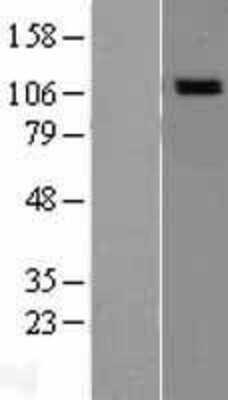 Western Blot: NOD1 Overexpression Lysate [NBL1-13705]