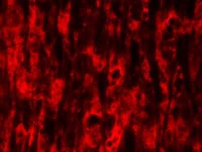 Immunohistochemistry: NOD2 Antibody (2D9) - Azide and BSA Free [NBP2-80883]