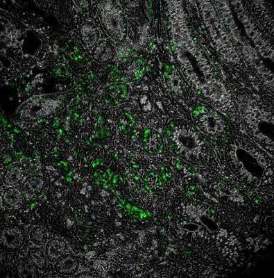 Immunohistochemistry: NOD2 Antibody (2D9) - Azide and BSA Free [NBP2-80883]