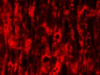 Immunohistochemistry: NOD2 Antibody (2D9) - BSA Free [NB100-524]