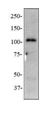 Western Blot: NOD2 Antibody (2D9)BSA Free [NB100-524]