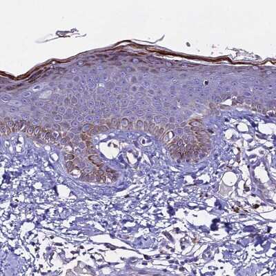 Immunohistochemistry-Paraffin: NOD2 Antibody [NBP2-48752]