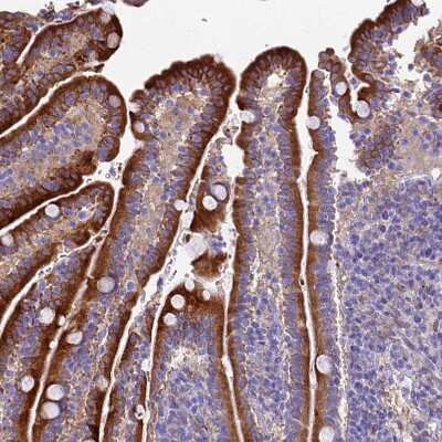 Immunohistochemistry-Paraffin: NOD2 Antibody [NBP2-48752]
