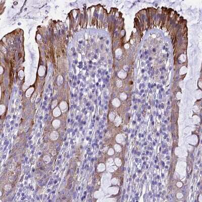 Immunohistochemistry-Paraffin: NOD2 Antibody [NBP2-48752]