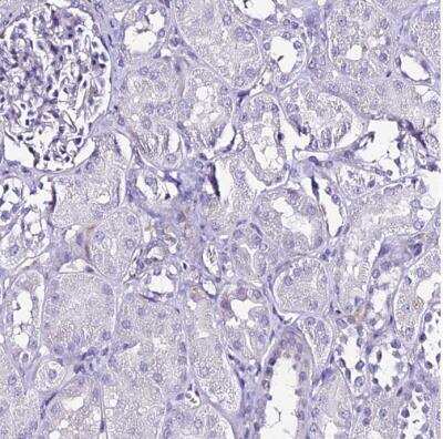 Immunohistochemistry-Paraffin: NOD2 Antibody [NBP2-48752]