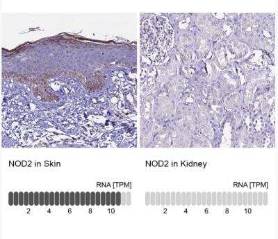 Immunohistochemistry-Paraffin: NOD2 Antibody [NBP2-48752]