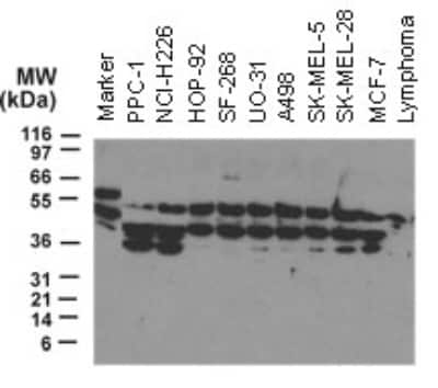 Western Blot: NOD2 Antibody [NBP2-27328]