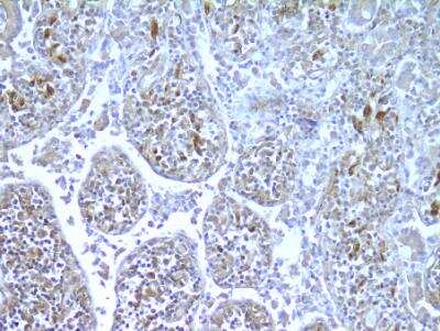Immunohistochemistry-Paraffin: NOD2 Antibody (hNOD2.017) [NBP3-11219]