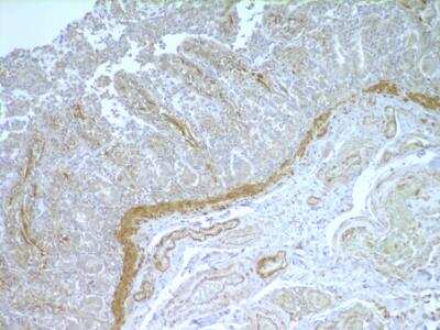 Immunohistochemistry-Paraffin: NOD2 Antibody (hNOD2.017) [NBP3-11219]