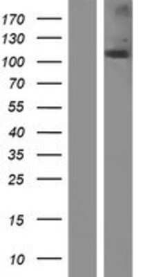 Western Blot: NOD2 Overexpression Lysate [NBP2-06456]