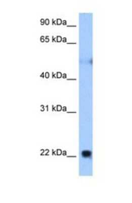 Western Blot: Nogo Antibody [NBP1-69284]