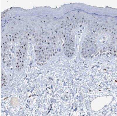 Immunohistochemistry-Paraffin: NOL1 Antibody [NBP1-92192]