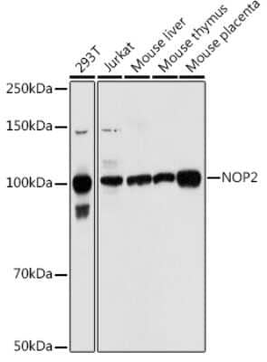 Western Blot: NOL1 AntibodyBSA Free [NBP3-15751]