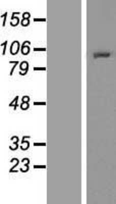 Western Blot: NOL1 Overexpression Lysate [NBP2-11047]