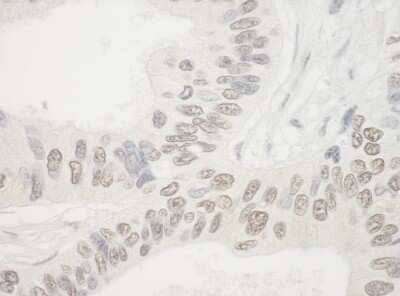 Immunohistochemistry: NOL10 Antibody [NBP1-47269]
