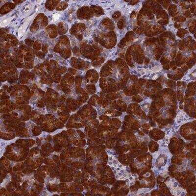 Immunohistochemistry-Paraffin: NOL10 Antibody [NBP1-83691]