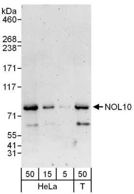 Western Blot: NOL10 Antibody [NBP1-47269]