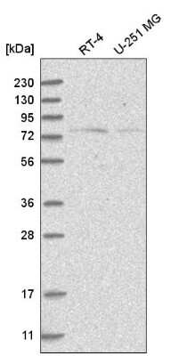 Western Blot: NOL10 Antibody [NBP2-55260]