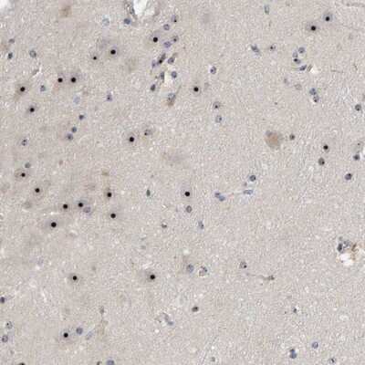 Immunohistochemistry-Paraffin: NOL11 Antibody [NBP1-90522]