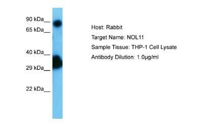 Western Blot: NOL11 Antibody [NBP2-83284]