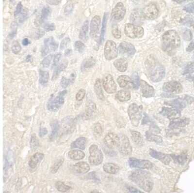Immunohistochemistry: NOL12 Antibody [NBP1-46174]