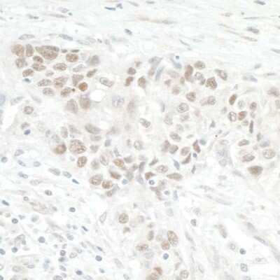 Immunohistochemistry: NOL12 Antibody [NBP1-46174]