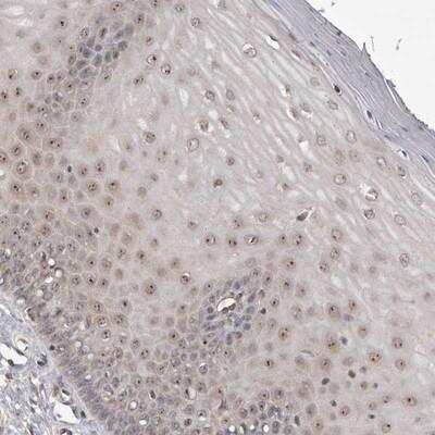 Immunohistochemistry-Paraffin: NOL12 Antibody [NBP1-86155]