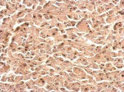 Immunohistochemistry-Paraffin: NOL12 Antibody [NBP2-19560]