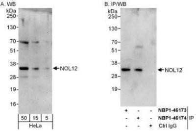 Western Blot: NOL12 Antibody [NBP1-46174]