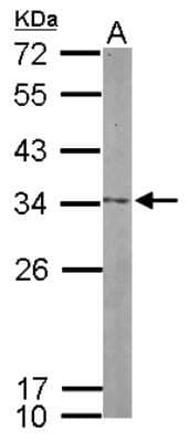 Western Blot: NOL12 Antibody [NBP2-19560]