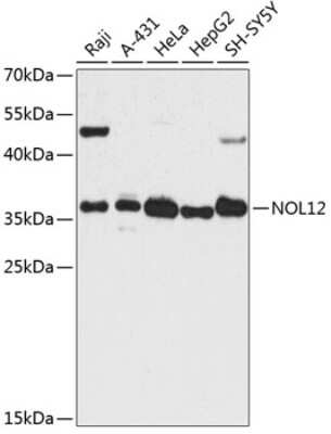 Western Blot: NOL12 AntibodyAzide and BSA Free [NBP2-93209]