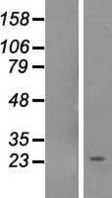 Western Blot: NOL12 Overexpression Lysate [NBL1-13709]