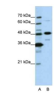 Western Blot: NOL4 Antibody [NBP1-57244]