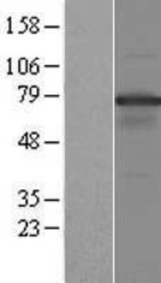 Western Blot: NOL4 Overexpression Lysate [NBP2-07955]