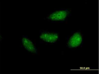 Immunocytochemistry/ Immunofluorescence: NOL6 Antibody [H00065083-B01P]