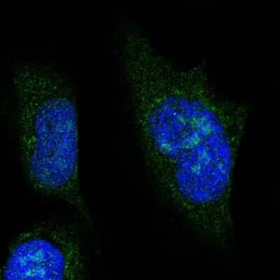 Immunocytochemistry/ Immunofluorescence: NOL6 Antibody [NBP2-47353]