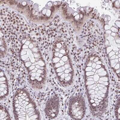 Immunohistochemistry: NOL6 Antibody [NBP2-47353]
