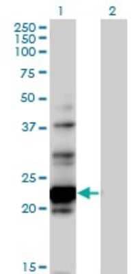 Western Blot: NOL6 Antibody [H00065083-B01P]