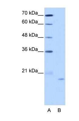 Western Blot: NOL6 Antibody [NBP1-57231]