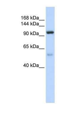 Western Blot: NOL6 Antibody [NBP1-57280]