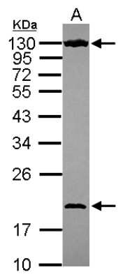 Western Blot: NOL6 Antibody [NBP2-19562]