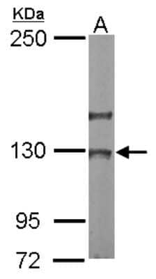 Western Blot: NOL6 Antibody [NBP2-19562]