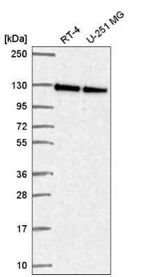 Western Blot: NOL6 Antibody [NBP2-57528]