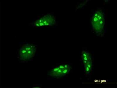 Immunocytochemistry/ Immunofluorescence: NOL7 Antibody [H00051406-B01P]