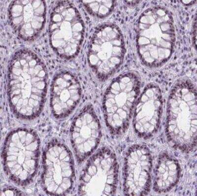 Immunohistochemistry-Paraffin: NOL7 Antibody [NBP1-86736]