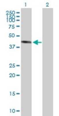 Western Blot: NOL7 Antibody [H00051406-B01P]