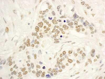 Immunohistochemistry: NOL8 Antibody [NBP1-46850]