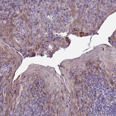 Immunohistochemistry-Paraffin: NOL8 Antibody [NBP1-92194]