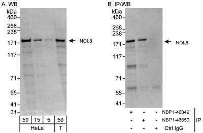 Western Blot: NOL8 Antibody [NBP1-46849]