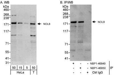 Western Blot: NOL8 Antibody [NBP1-46850]